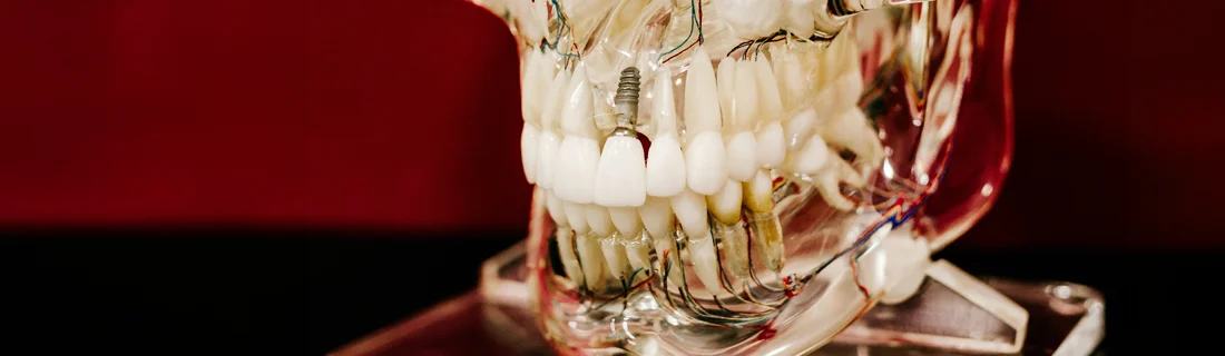 FC – Dental Implants at Shoreline Dental in Ocean Township NJ